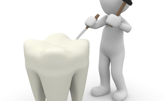 Tratamento de canal dentário